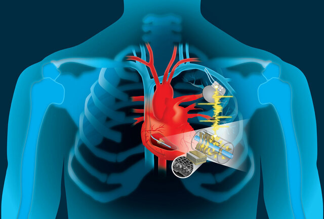 دستگاه قلبی عروقی
