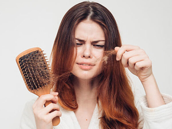 نقش تغذیه در نگهداری موی سر (هورمون DHT)