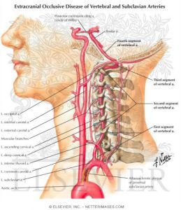 What is a bacillary artery?