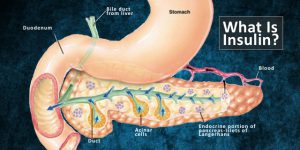 Where insulin is made in the pancreas