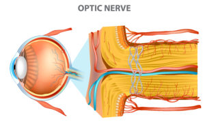 Optical neuropathy