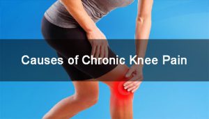 Causes of chronic knee pain