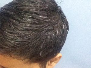 How to prevent hair bleaching