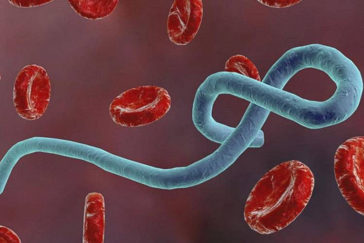 ابولا چیست؟